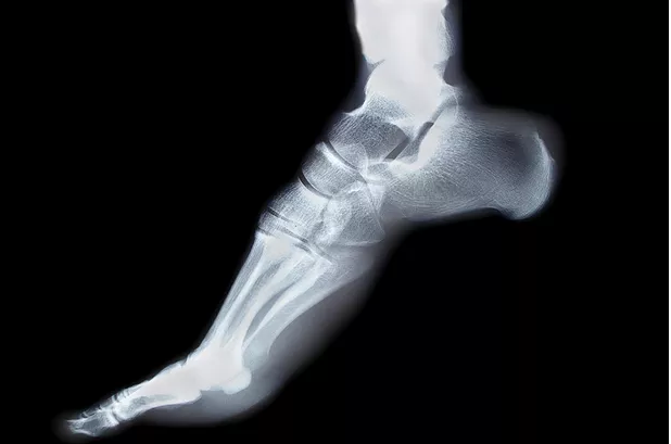 podiatry_xray